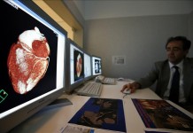 Un médico explica en un ordenador algunas de las investigaciones sobre la fibrilación auricular, conocida en inglés como "afib", una de las afecciones del corazón más comunes. EFE/Archivo